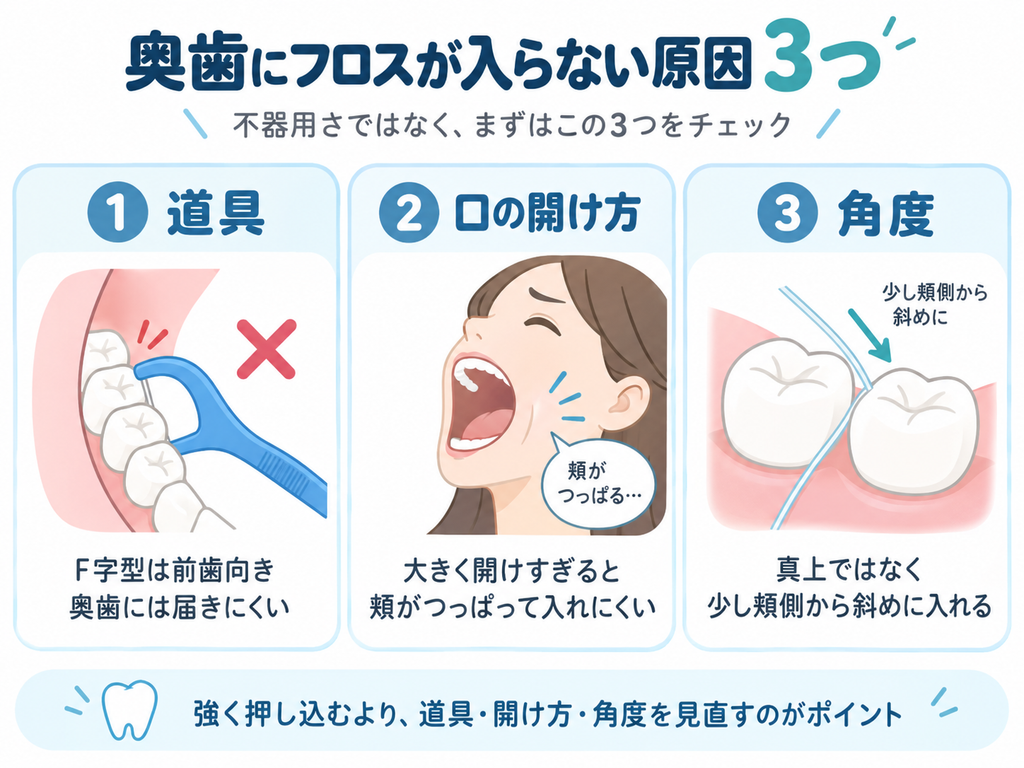 フロスの道具、口の開け方、角度
