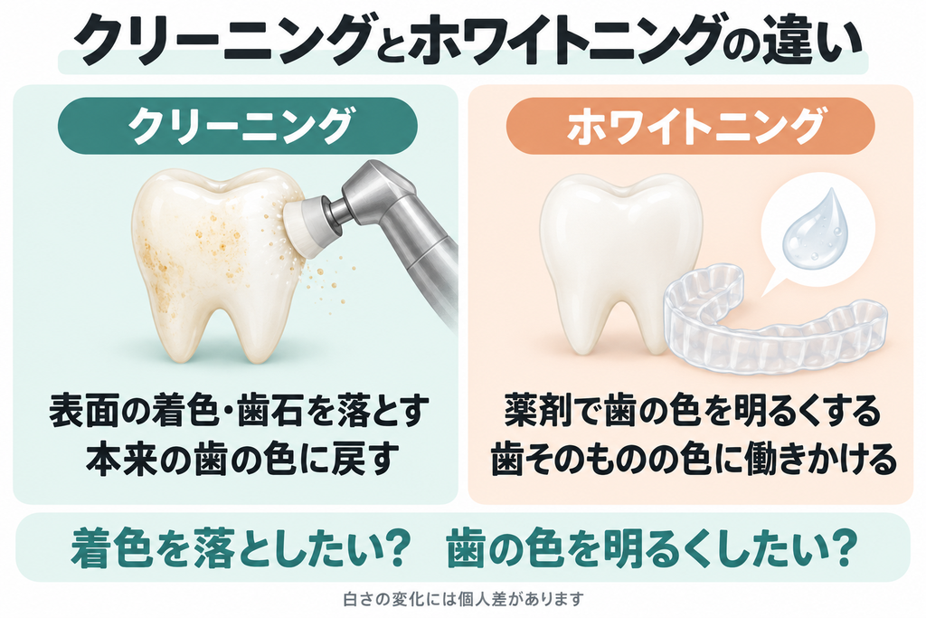 クリーニングは表面の着色や歯石を落として本来の歯の色に戻す。ホワイトニングは薬剤で歯そのものの色を明るくする。白さの変化には個人差がある。