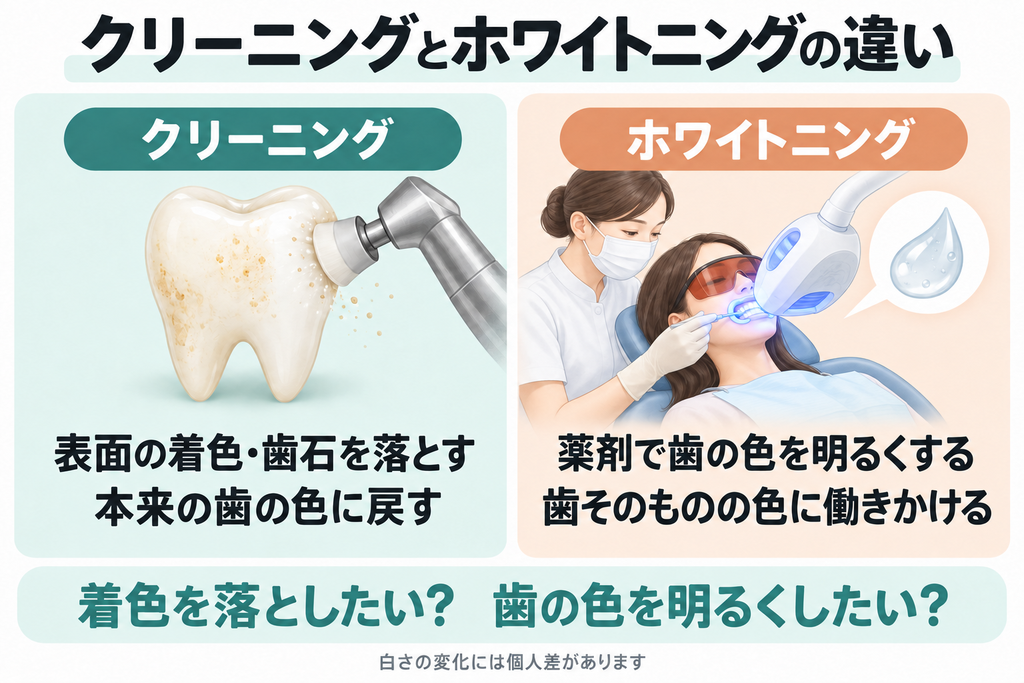 過酸化物を使わないセルフホワイトニングは表面の着色ケア。歯科のホワイトニングは過酸化物の薬剤で歯そのものの色を明るくする。効果や適応には個人差がある。