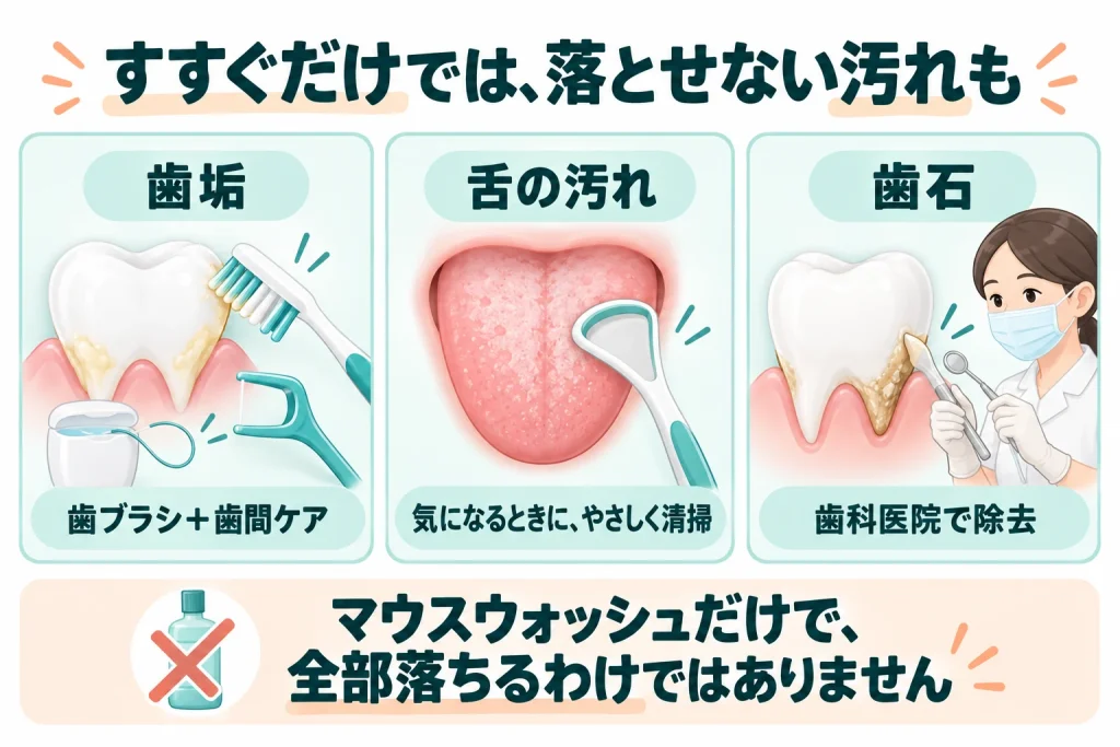 歯垢は歯ブラシと歯間ケア、気になる舌の汚れは舌ブラシでやさしく清掃し、付着した歯石は歯科医院で除去する。