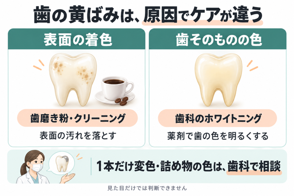 歯の黄ばみには表面の着色と歯そのものの色がある。表面の着色は歯磨き粉やクリーニングでケアし、歯そのものの色は歯科のホワイトニングを相談する。